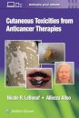 Cutaneous Toxicities from Anticancer Therapies