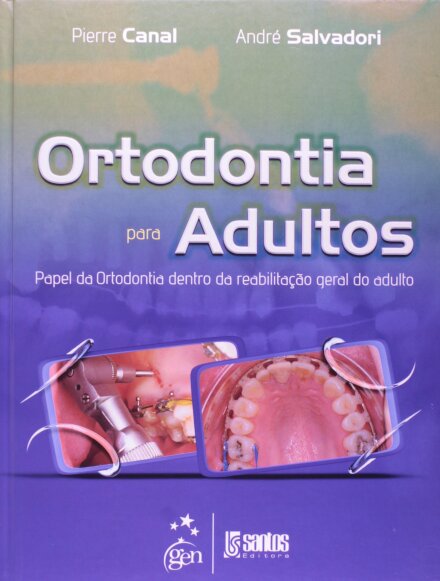 Ortodontia Para Adultos