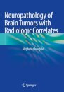 Neuropathology of Brain Tumors with Radiologic Correlates