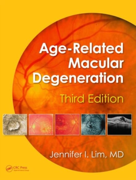 Age-Related Macular Degeneration, Third Edition