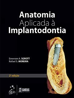 Anatomia Aplicada À Implantodontia
