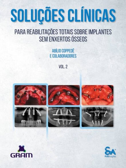 Soluções Clínicas Para Reabilitações Totais Sobre Implantes Sem Enxertos Ósseos - Vol. 2