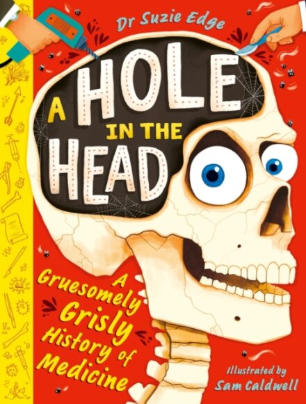 A Hole in the Head