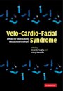 Velo-Cardio-Facial Syndrome