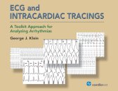 ECG and Intracardiac Tracings