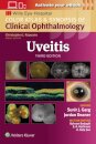 Uveitis