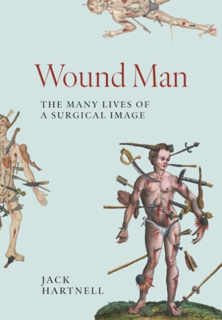 Wound Man