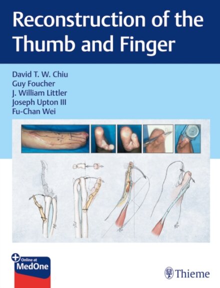 Reconstruction of the Thumb and Finger