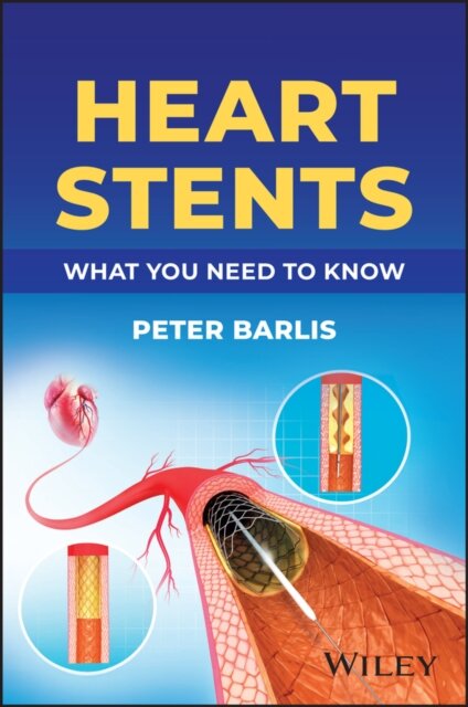 Heart Stents