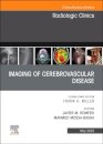 Imaging of Cerebrovascular Disease, An Issue of Radiologic Clinics of North America