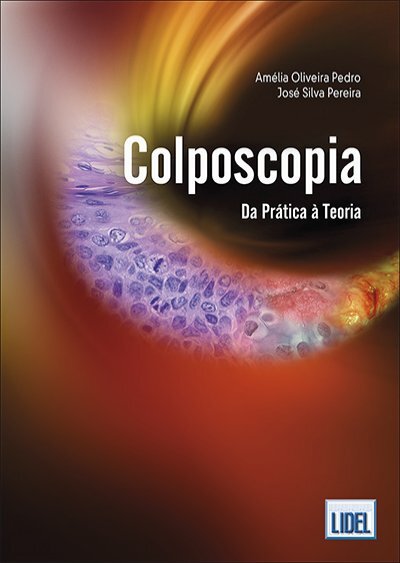 Colposcopia