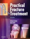 Practical Fracture Treatment
