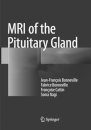 MRI of the Pituitary Gland