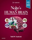 Nolte's The Human Brain in Photographs and Diagrams