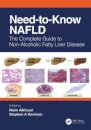 Need-to-Know NAFLD