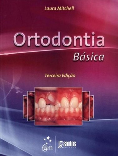 Ortodontia Básica