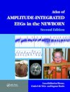 An Atlas of Amplitude-Integrated EEGs in the Newborn