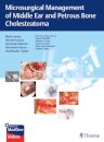 Microsurgical Management of Middle Ear and Petrous Bone Cholesteatoma