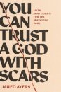 You Can Trust a God with Scars
