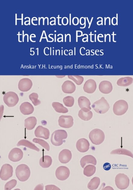 Haematology and the Asian Patient