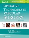 Operative Techniques in Vascular Surgery: Print + eBook with Multimedia