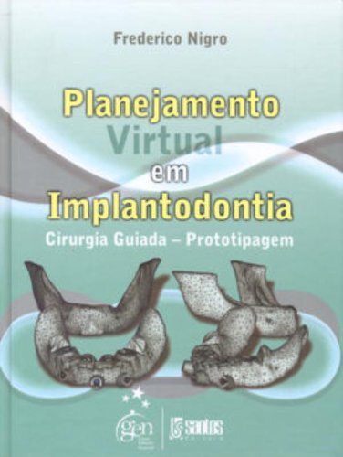 Planejamento Virtual Implantodontia Cirurgia Guiada