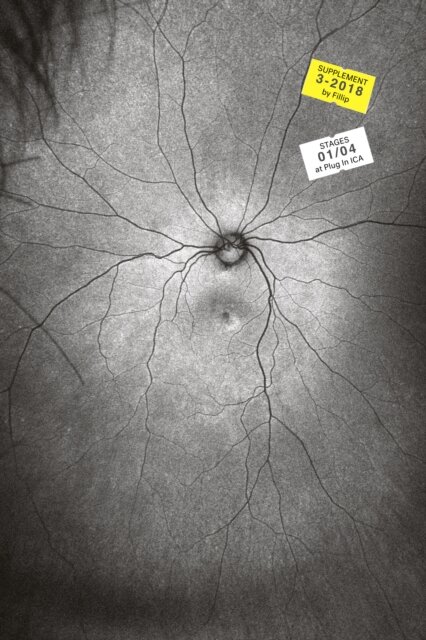 Supplement 3: The Invention and Conclusion of the Eye