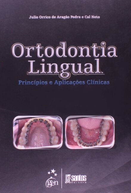 Ortodontia Lingual Princípios E Aplicações Clínicas