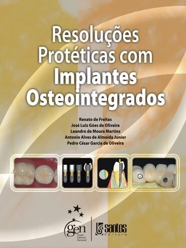 Resoluções Protéticas Com Implantes Osteointegrados