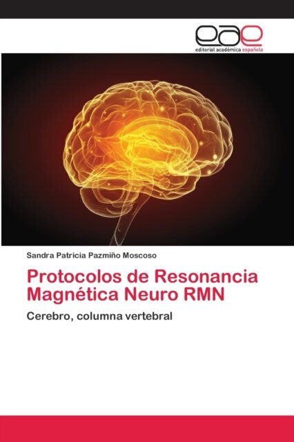 Protocolos de Resonancia Magnetica Neuro RMN