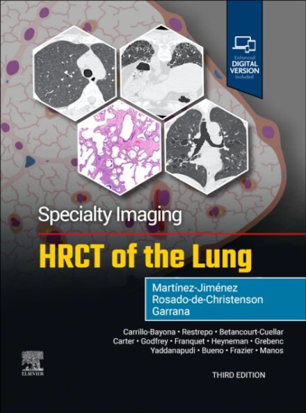 Specialty Imaging: HRCT of the Lung