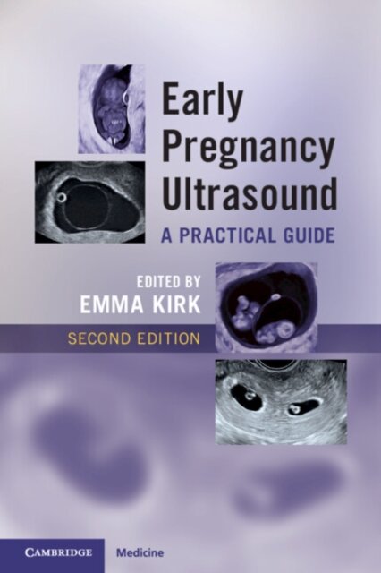 Early Pregnancy Ultrasound